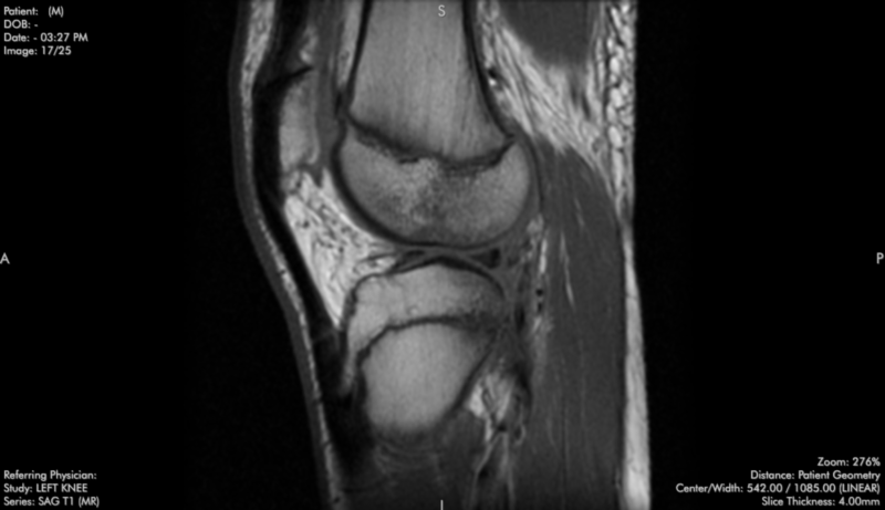 Hand-picked MRI cases