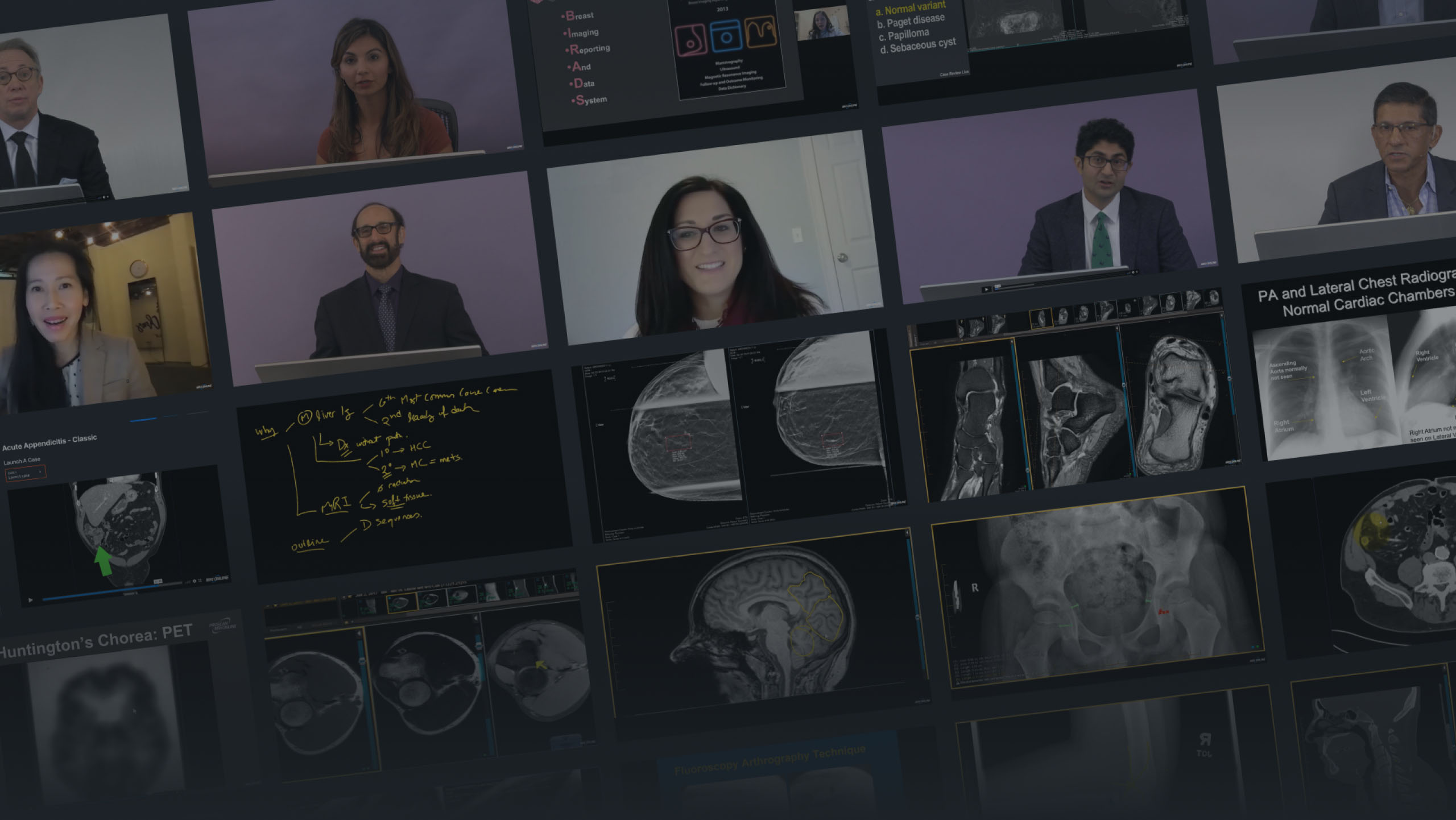 Radiology CME Online Courses & Fellowships MRI Online